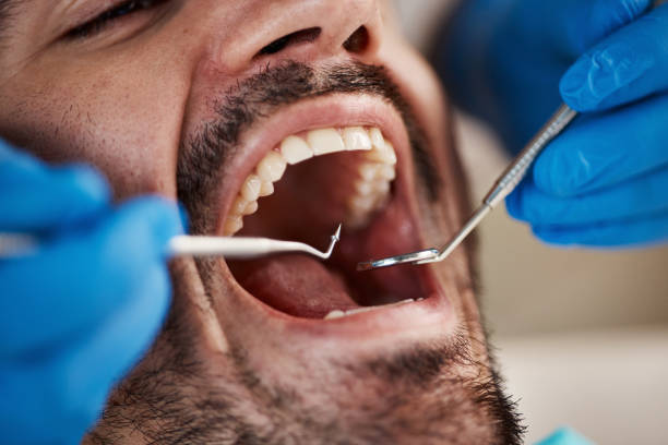Best Emergency Tooth Extraction in Pottsville, AR